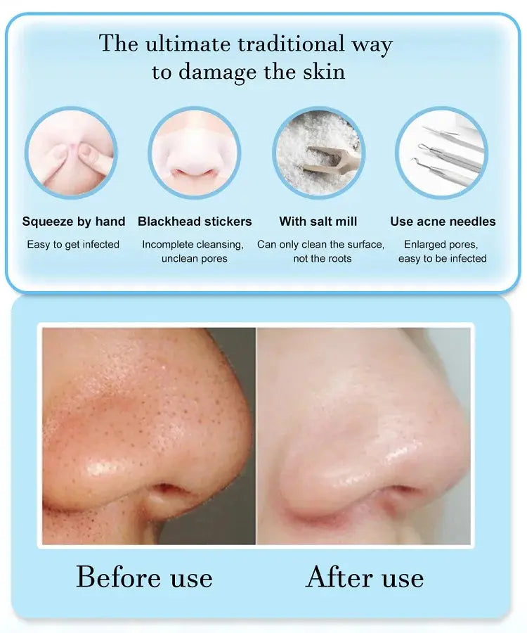 3 Suction Mode Face Cleansing Beauty Machine Dead Skin Remover Face Vacuum Blackhead Removal Skin Drovia